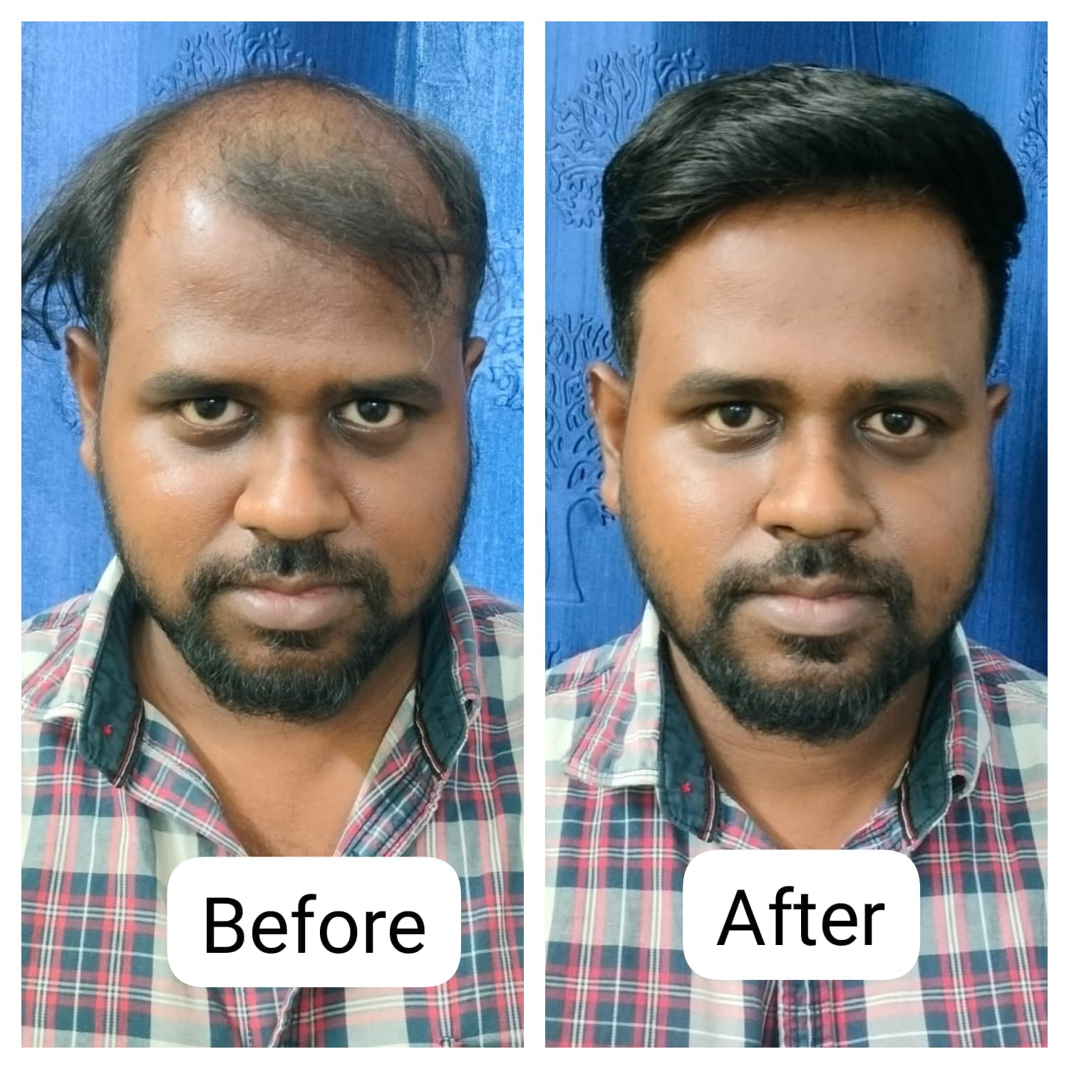 Hair fixing services for men and women in Chennai